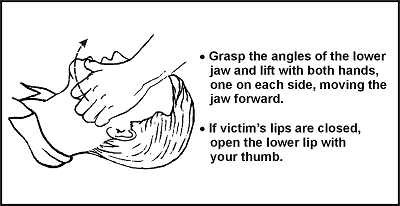 Figure 4-1. Jaw Thrust Method